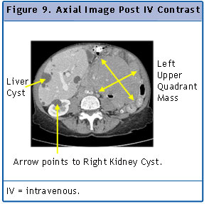 Figure 9