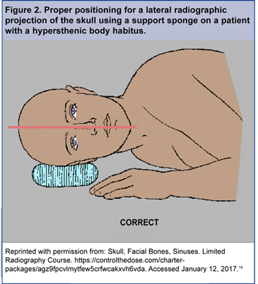 habitus cranial indices