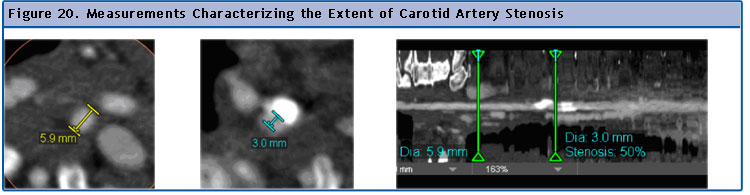 Figure 20