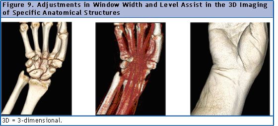Figure 9