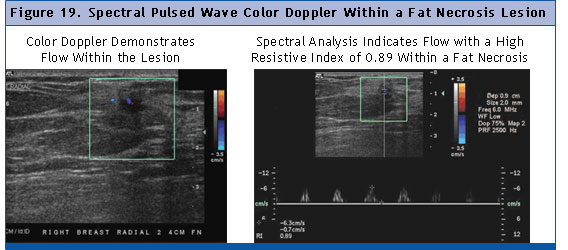 Figure 19