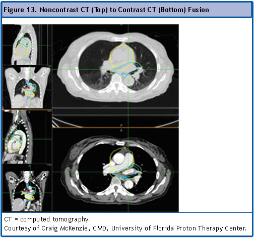Figure 13